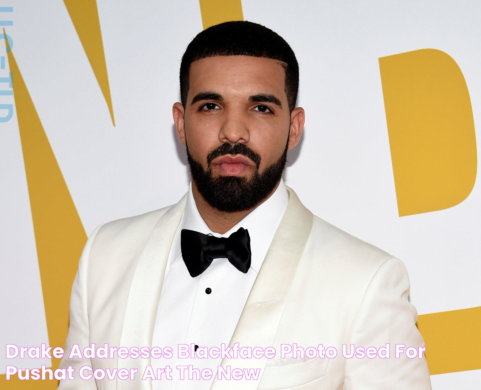 All About Drake's Nose Job: A Deep Dive Into The Rumors And Facts