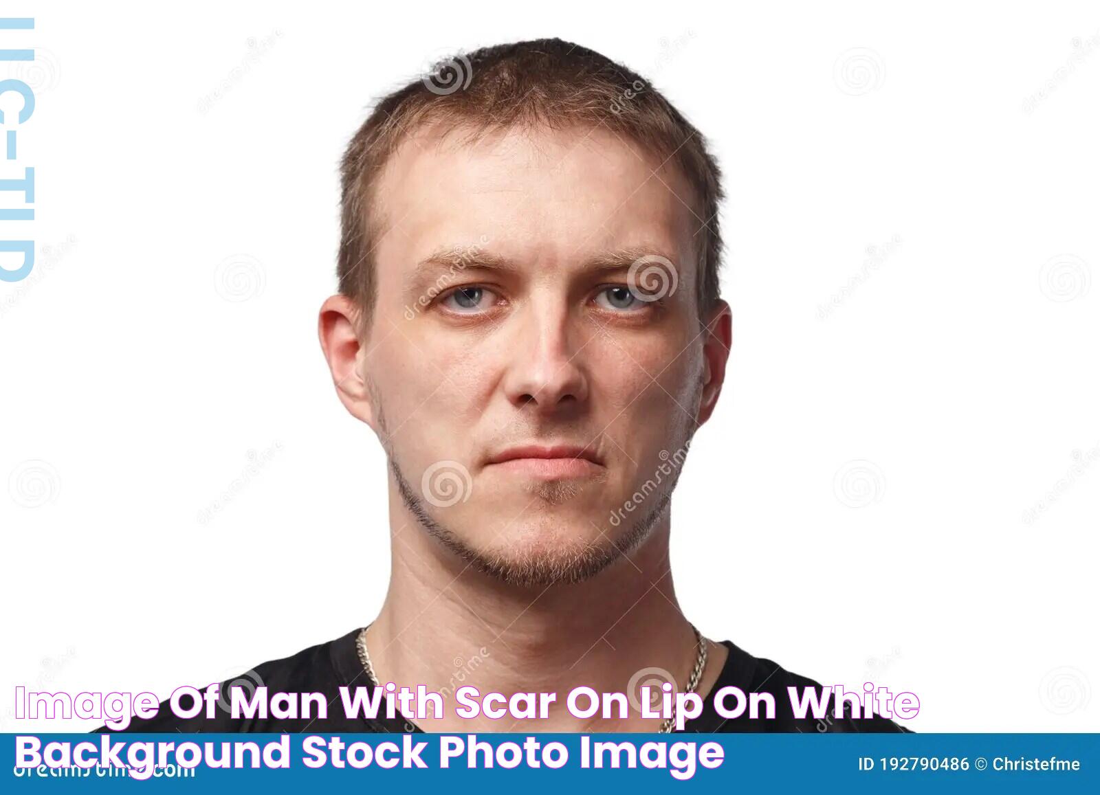 Image of Man with Scar on Lip on White Background Stock Photo Image