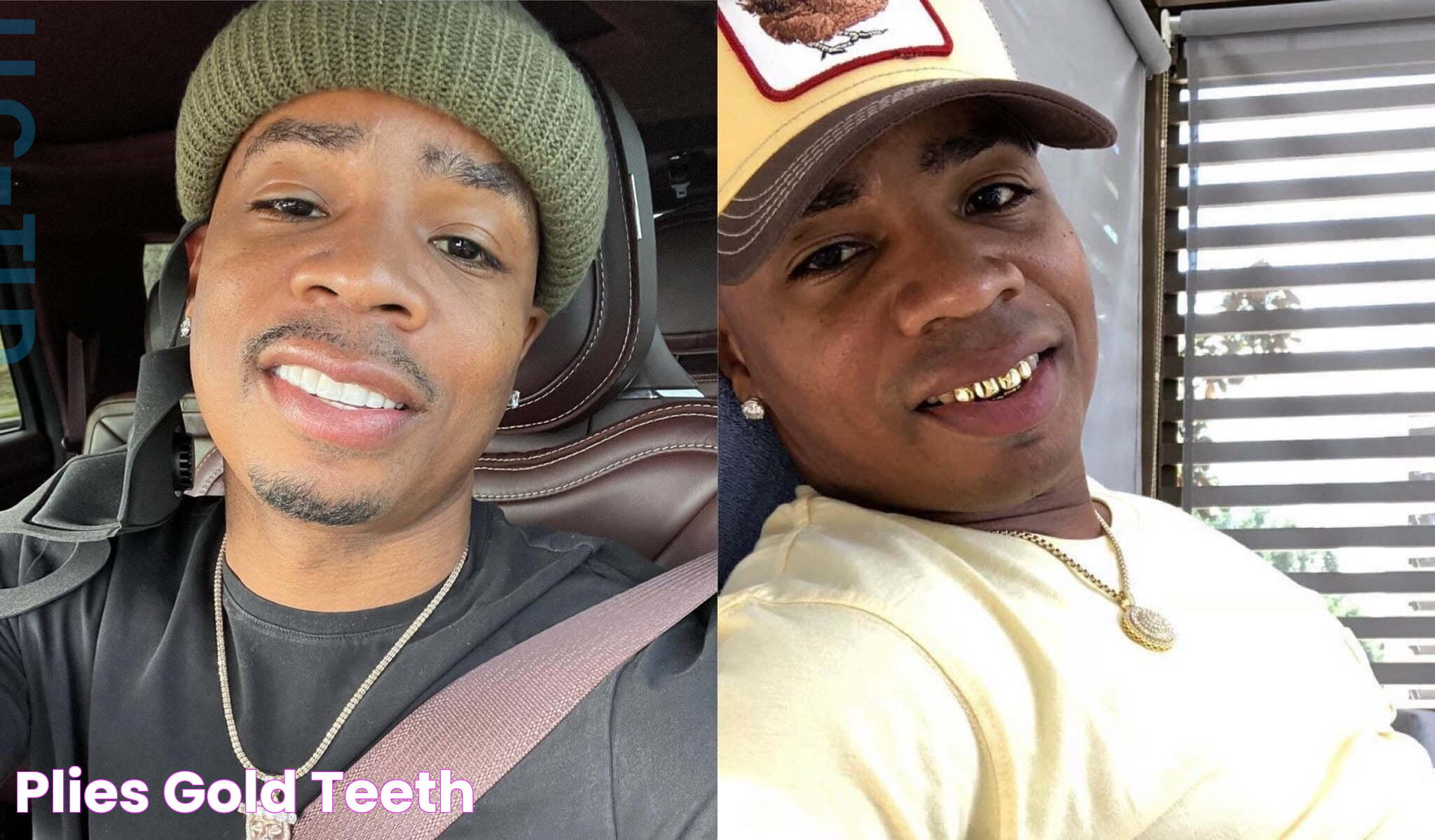 Plies Teeth: Understanding The Connection With Health And Well-being