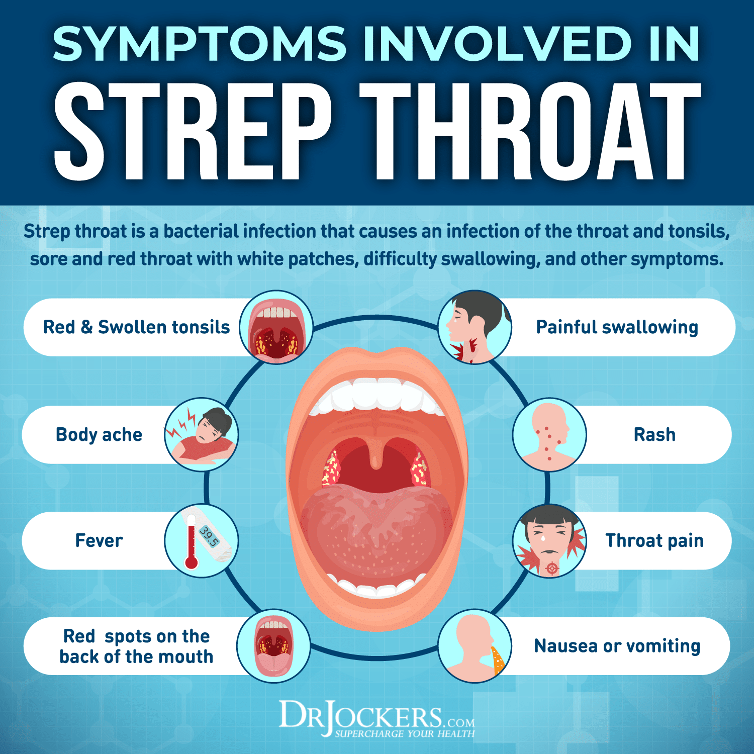 Strep Throat Symptoms and 15 Natural Support Strategies