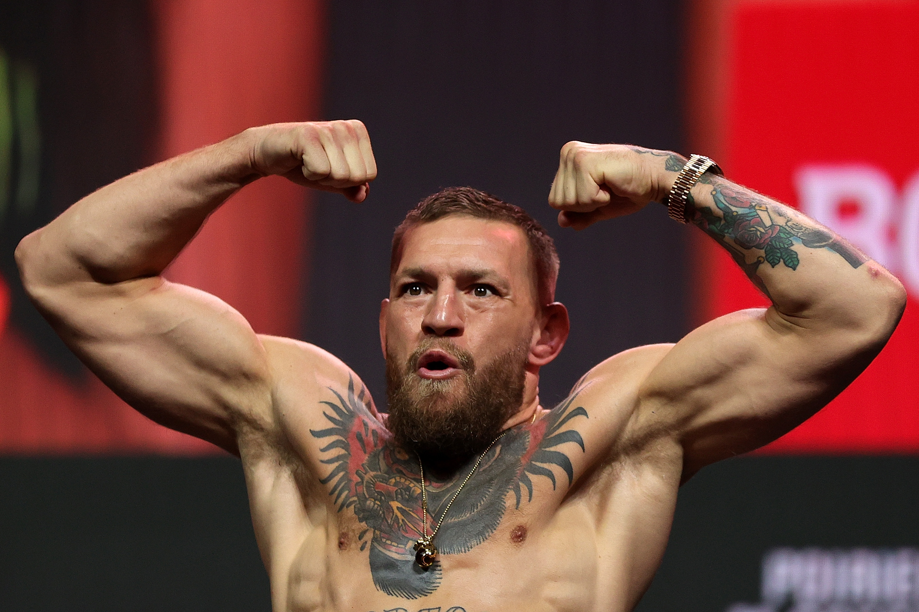 Conor McGregor Remains Unbothered Despite Broken Leg